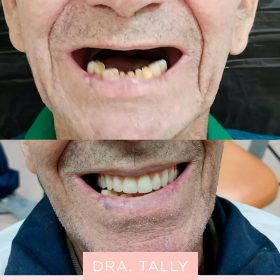 img implantes dentarios dra tally (4)