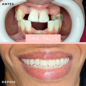 img implantes dentarios dra tally